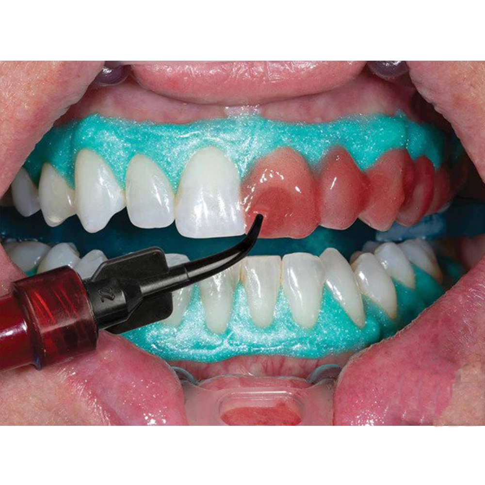 Ultradent Opalescence Boost Pf 40% Plus Mini Kit # 4751-1