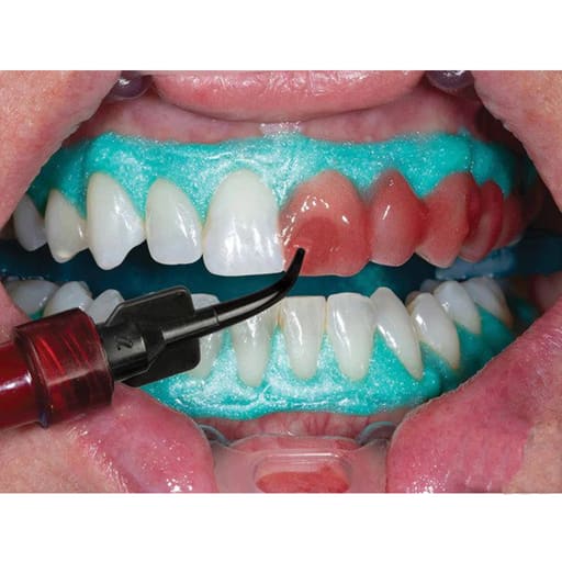 Ultradent Opalescence Boost Pf 40% Plus Mini Kit # 4751-1