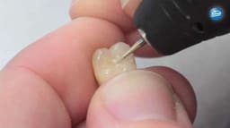 SuperEndo Composite & Porcelain Finishing Bur Kit - 7