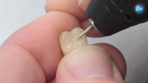SuperEndo Composite & Porcelain Finishing Bur Kit