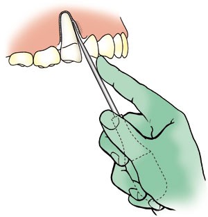 GDC Luxatip - 5mm Straight (L5s)