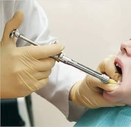 GDC Dental Syringe Aspirating With Ring (2.2ml) (SYRA2.2) - 5