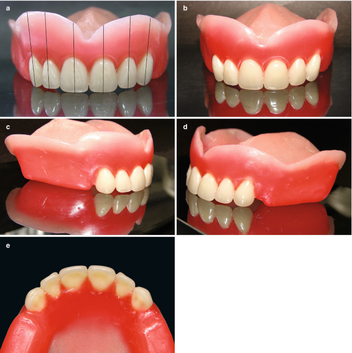 2GM PrestoRock Teethset A3 (Pack of 4 Sets)