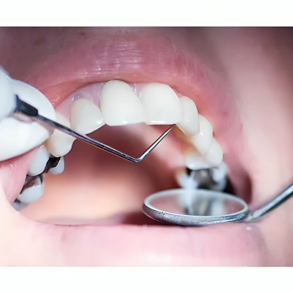 Oracraft Conservative Kit Instruments Set Of 19 In Pouch - CIP19