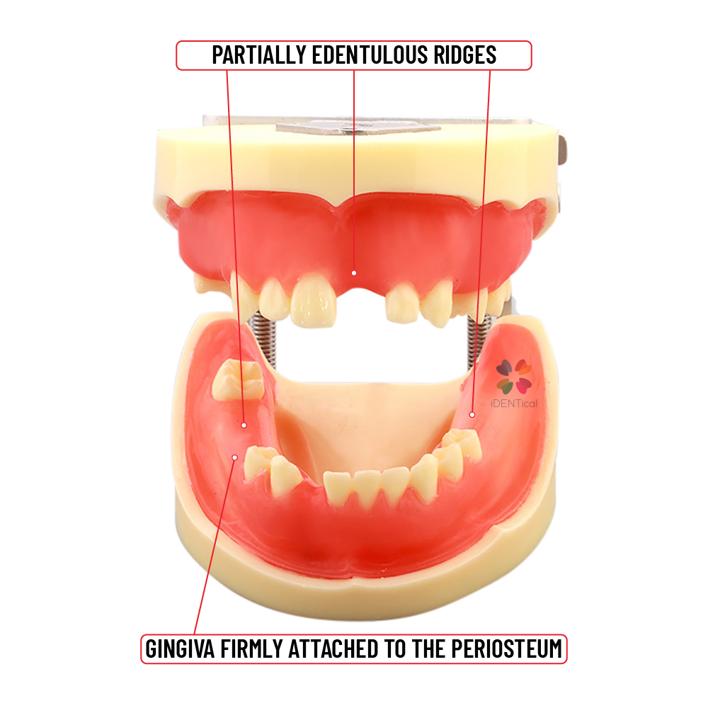 iDENTical Dental Implant Practicing Model With Articulator - M2002