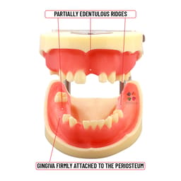 iDENTical Dental Implant Practicing Model With Articulator - M2002 - 5