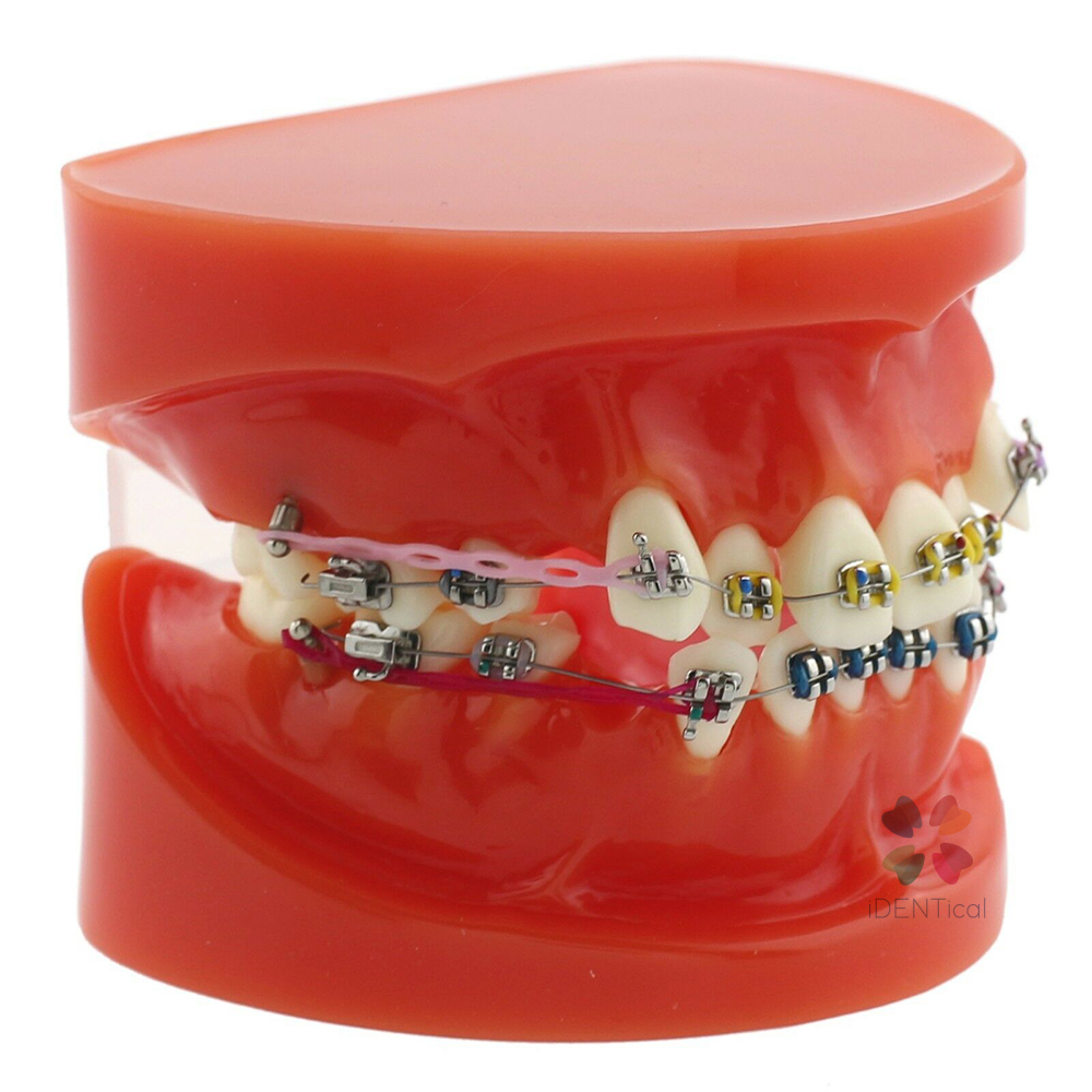 iDENTical Dental Orthodontic Models M3005