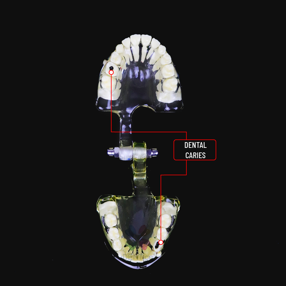 IDENTical Paediatric Model with Pathologies M4002 