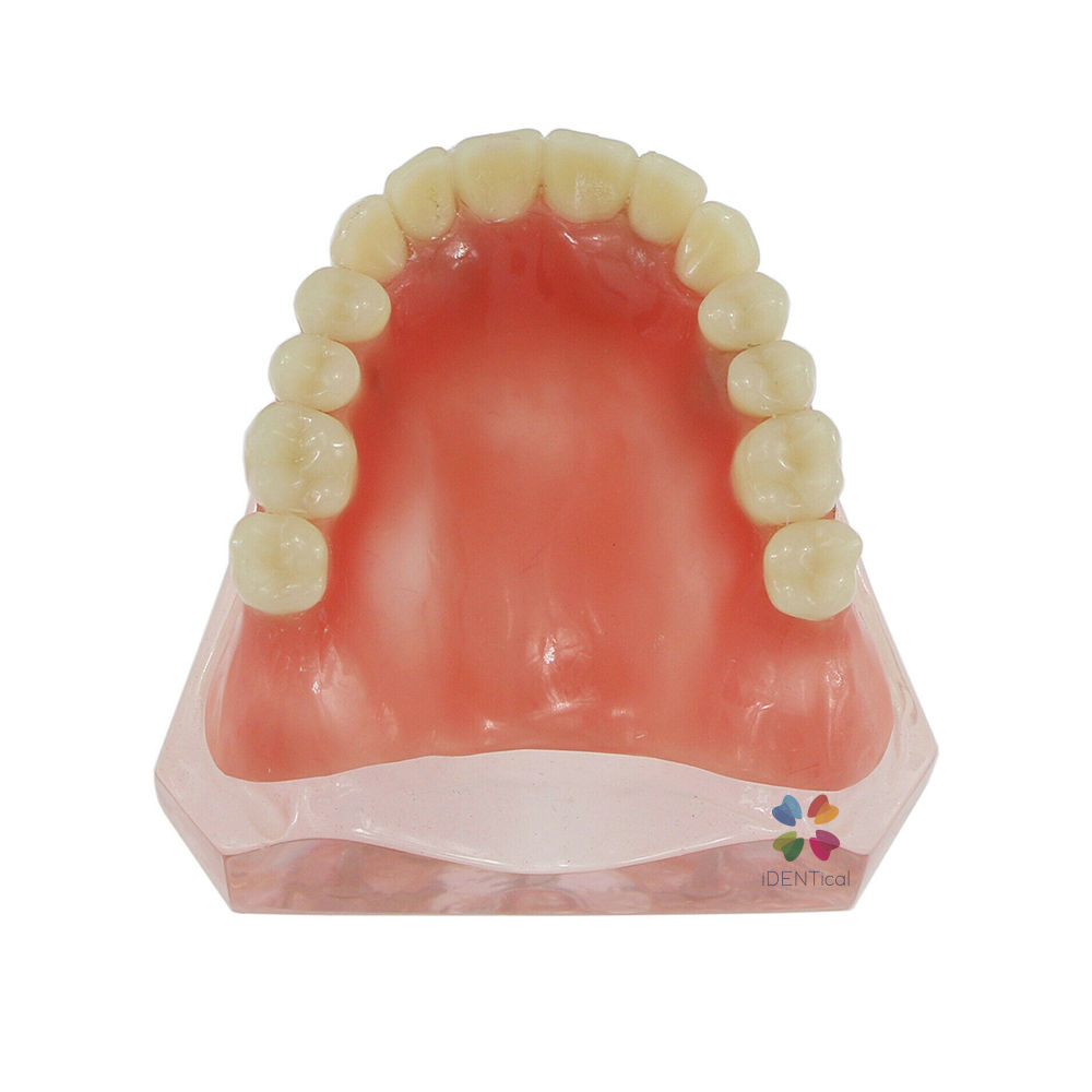 iDENTical Dental Model for Overdenture Maxilla M6001
