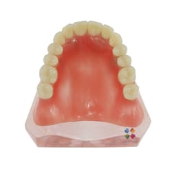 iDENTical Dental Model for Overdenture Maxilla M6001 - 5