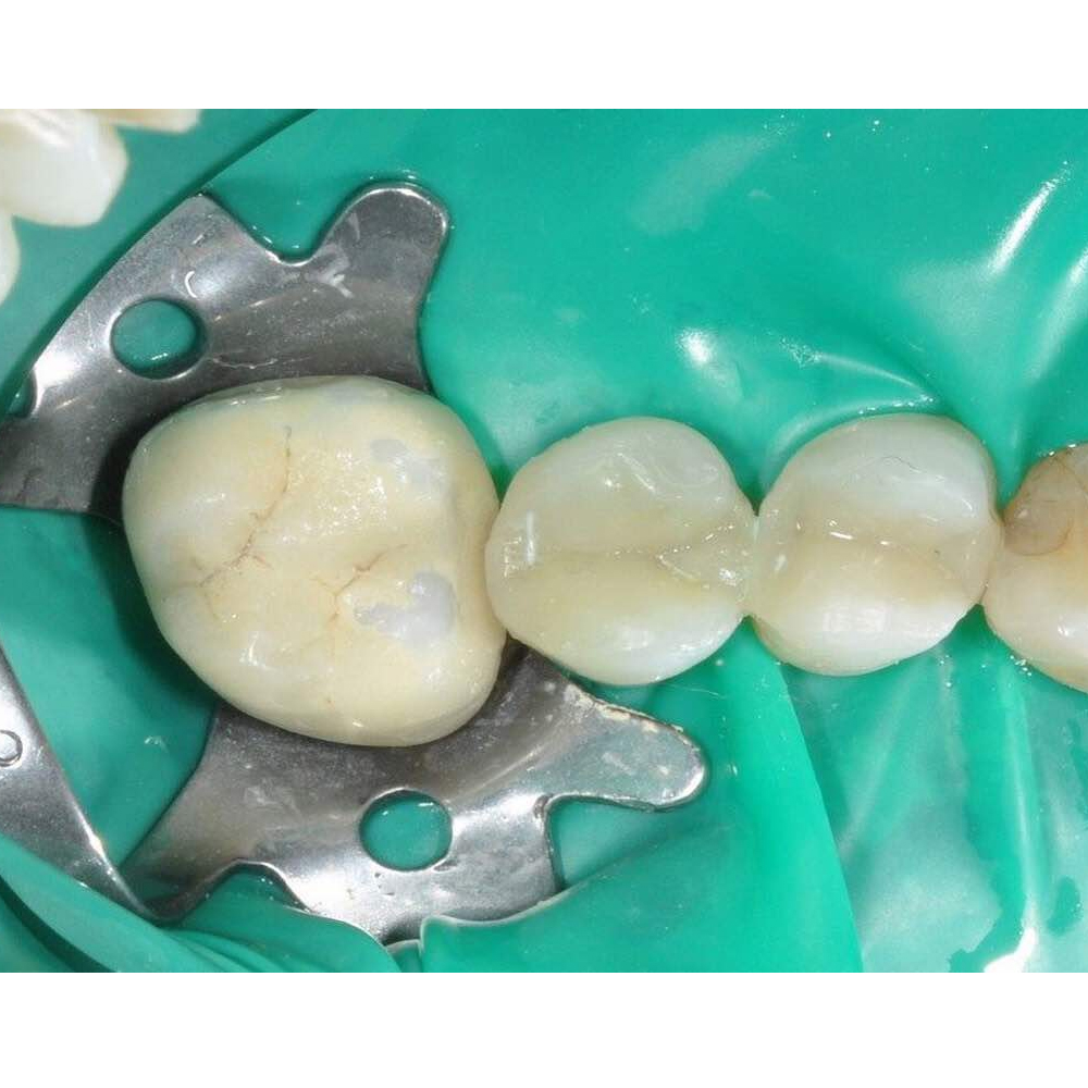 GDC Rubber Dam Clamp Adult 4 (Rdc4)