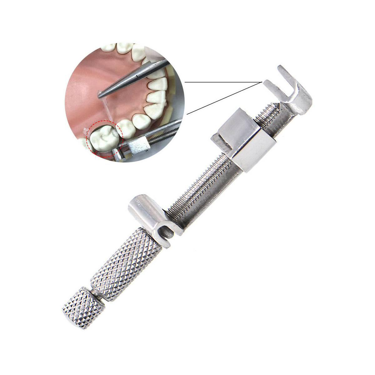 Waldent Tofflemire Retainer 8/105