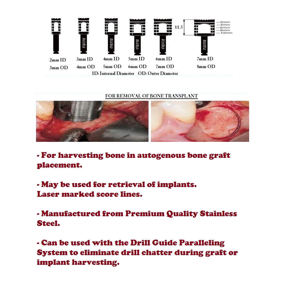 Julldent Trephine Drills Set