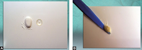 Tokuyama Tokuso Ionomer GIC Luting Cement