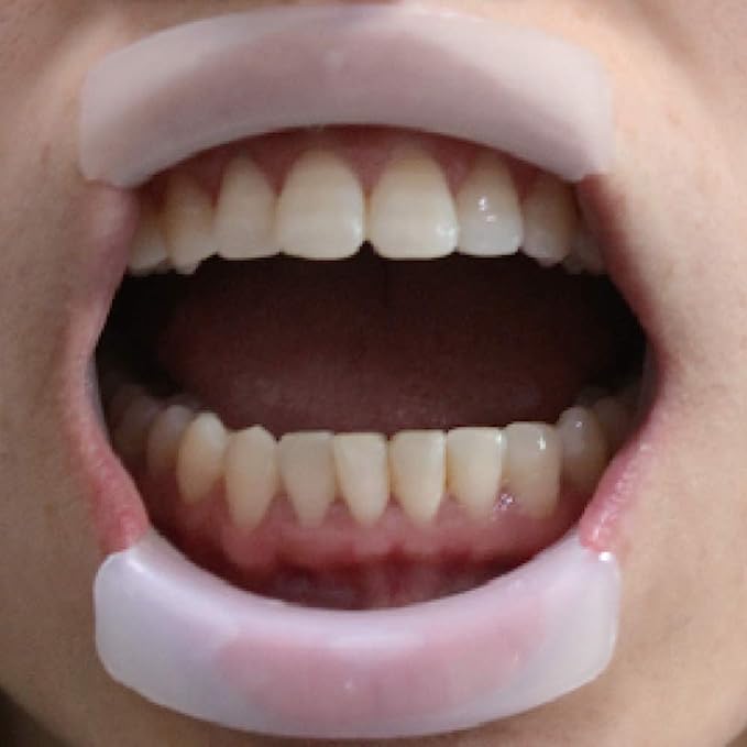 ET Dental Cheek Retractor O Type