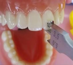 Waldent Bracket Positioning Height Gauge 0.18/0.22 - 6