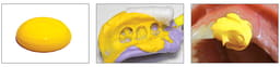 Neosil Peakosil A-Silicone Putty + Light Body Combo Start Kit - 4