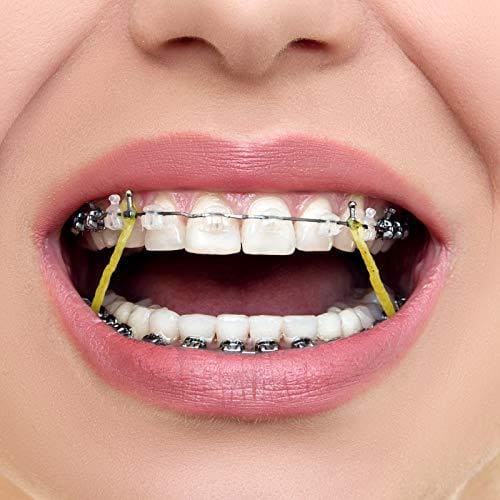 Penta Ortho Intraoral Elastics - Light & Medium (Pack of 1000)