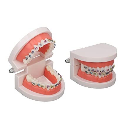 Patient Education Model With Orthodontic Brackets MD-119