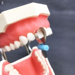 ET Dental Automatrix Metal Bands With Locker - 9