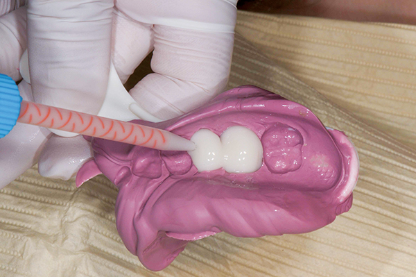 Coltene Whaledent Cooltemp Natural