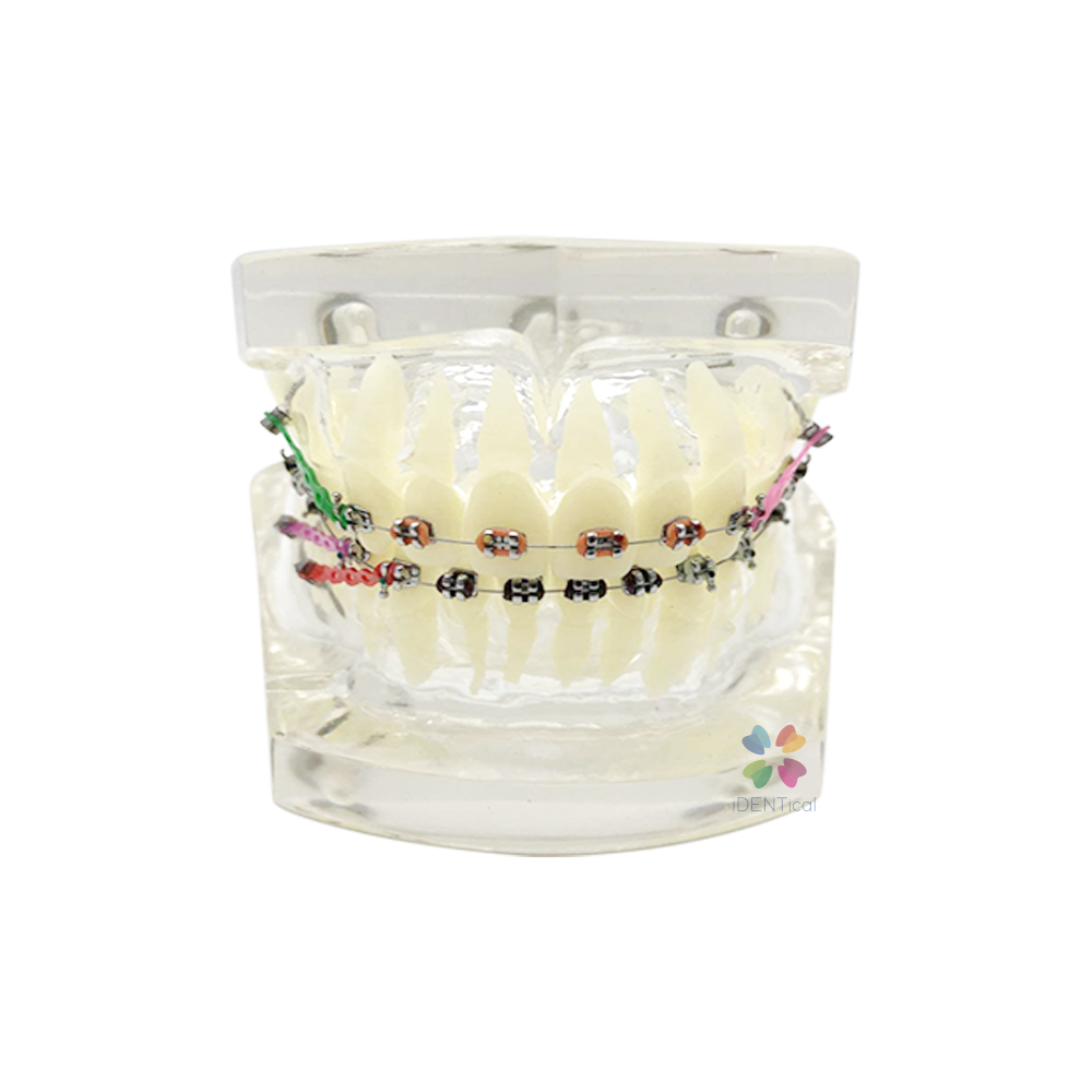 iDENTical Dental Orthodontic Models M3005