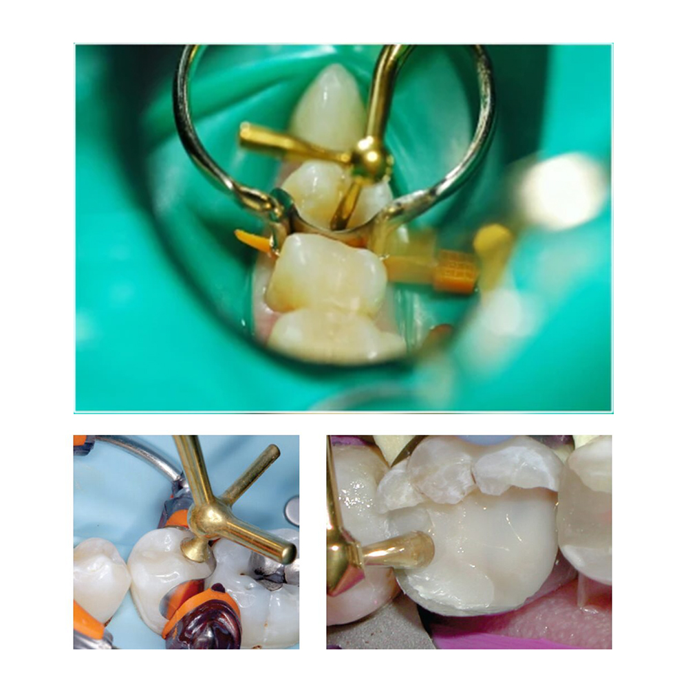 Waldent Composite Instrument Titanium Nitride Coated