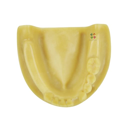  iDENTical Mandibular Implant Practicing Model M2028