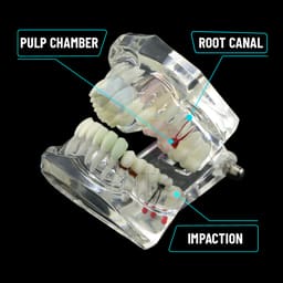 iDENTical All In One Dental Implant Model - M2001 (White) - 7