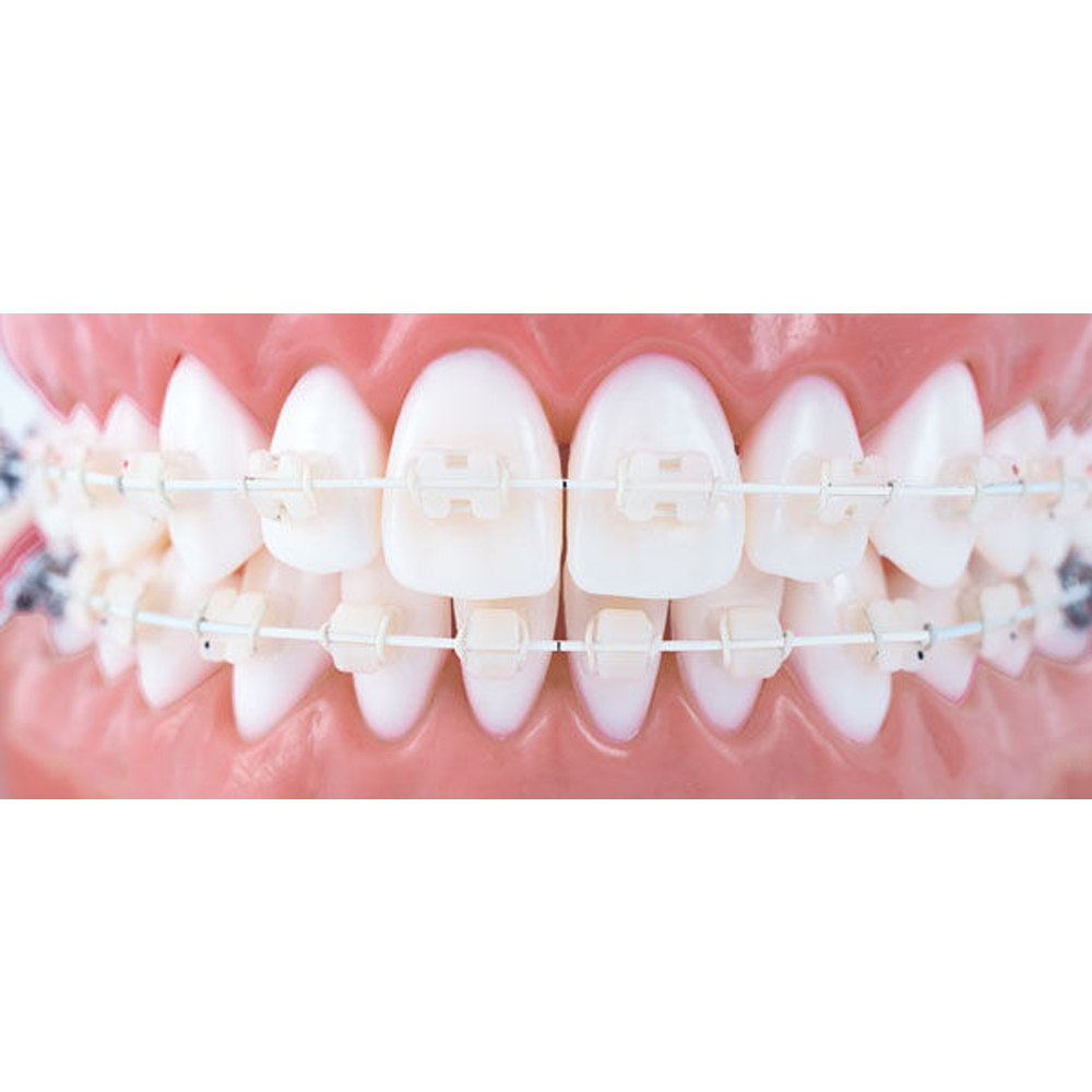 U ortho Niti Tooth Color Wire-Rectangular (Pack of 1)