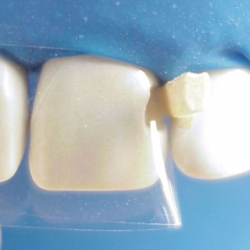 Tor Vm Transparent Striprolls