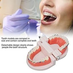 Patient Education Model With Orthodontic Brackets MD-119 - 7