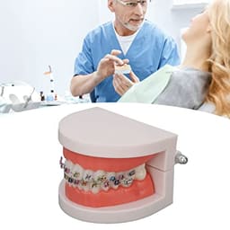 Patient Education Model With Orthodontic Brackets MD-119 - 8