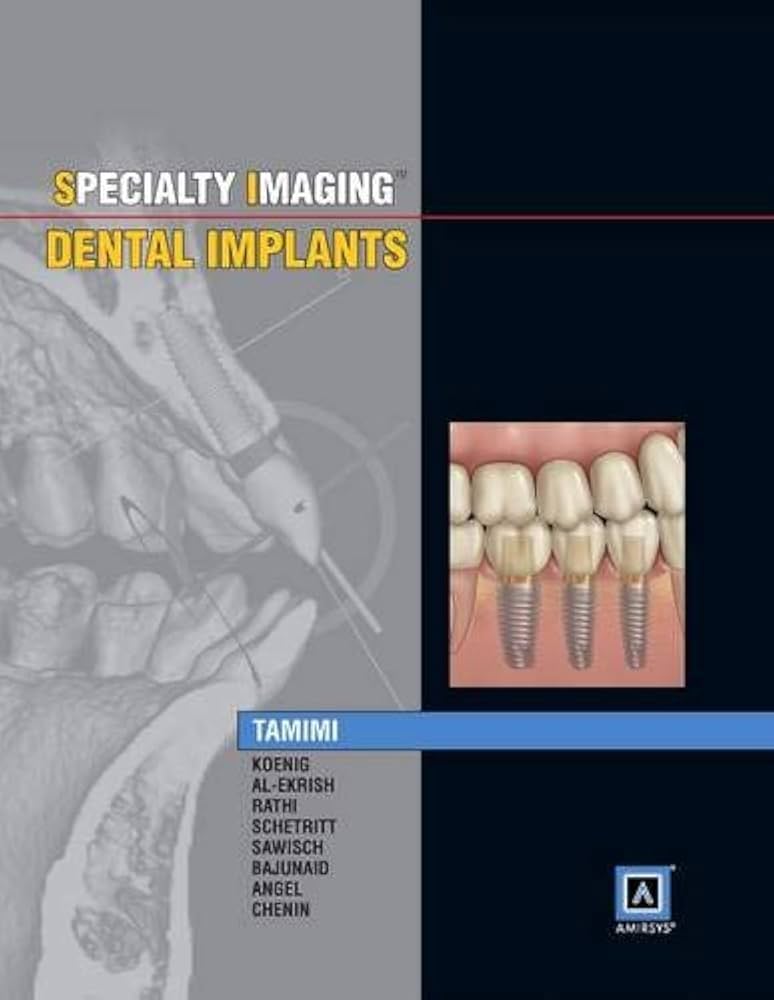 Specialty Imaging: Dental Implants (ISBN - 242190)