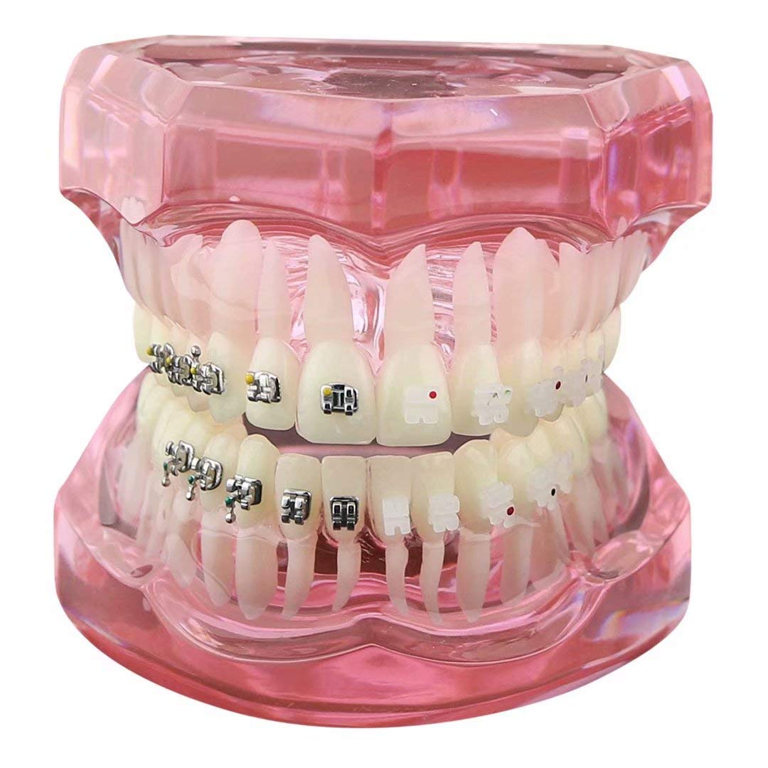 iDENTical Half Metal and Half Ceramic Brackets Orthodontic Models M3003