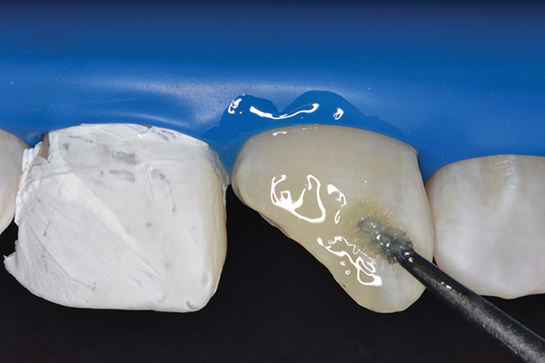 Cotisen Dental Micro Applicators Tips