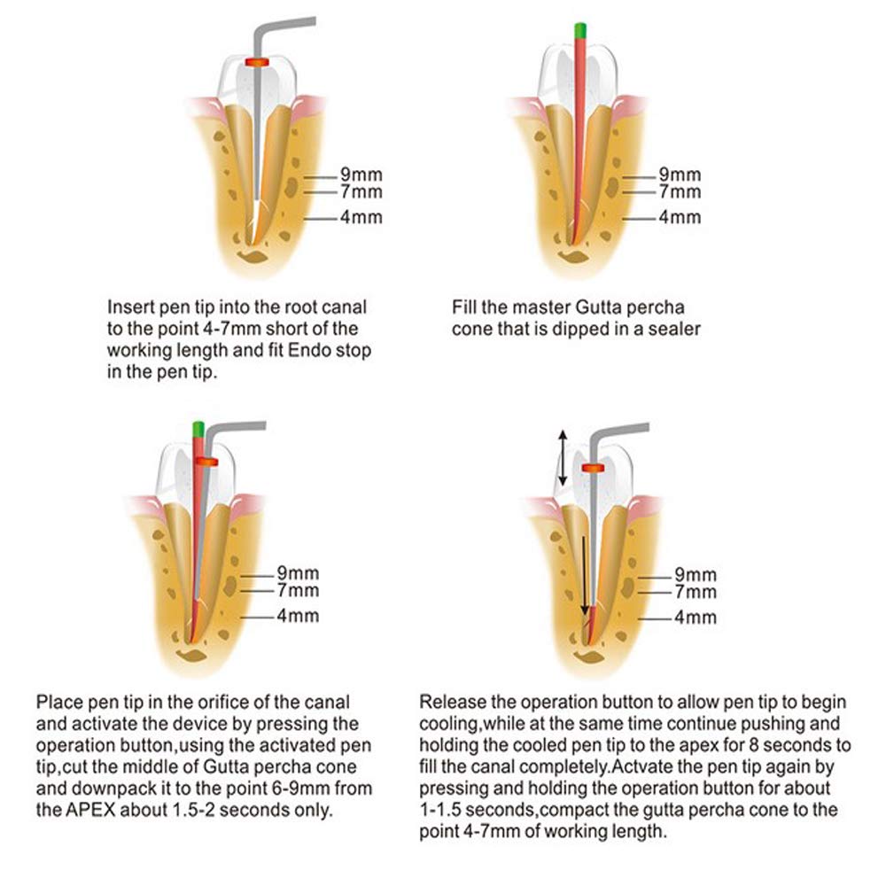Endoking Dental Obturation Pen Tips	