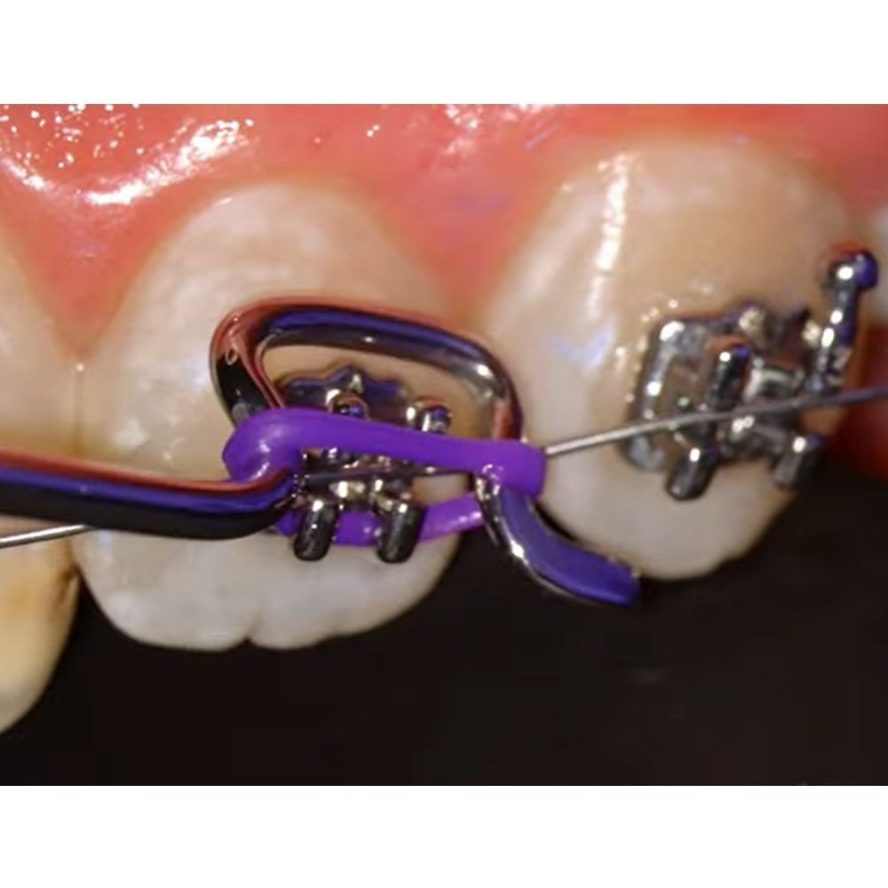 GDC Ortho Elastic Ligature Applicator #1 (674)