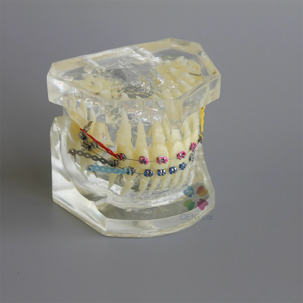 iDENTical Dental Orthodontic Models M3005