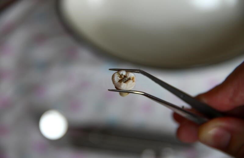 Waldent London College Tweezers (13/104)