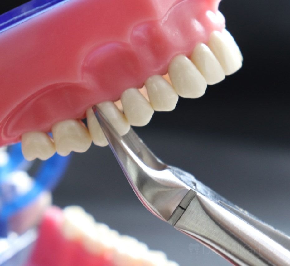 GDC Extraction Forceps Upper Molars Right Standard - (FX89S)