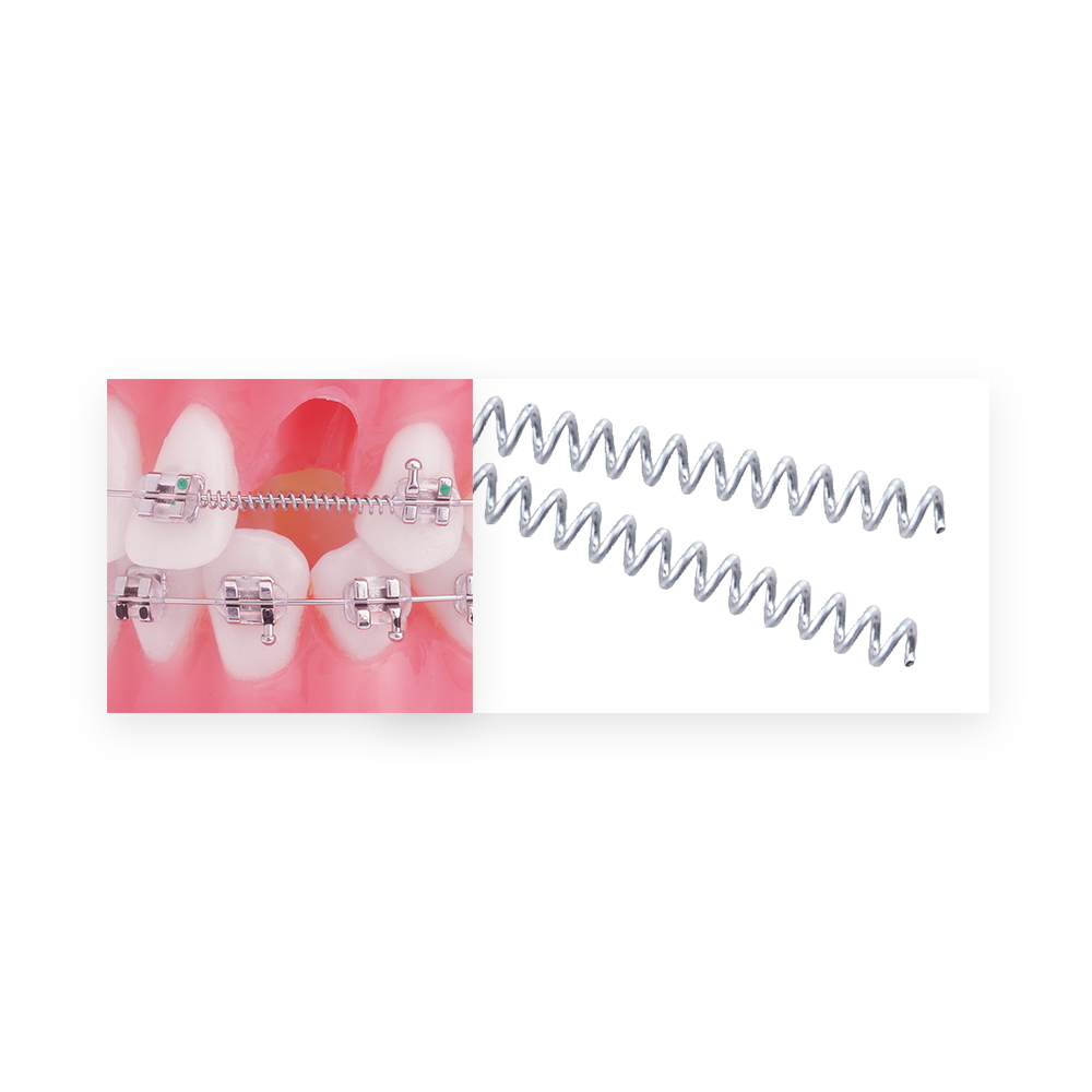 U Ortho NiTi Open Spring 0.010 Inch 180mm