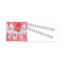 U Ortho NiTi Open Spring 0.010 Inch 180mm - 10