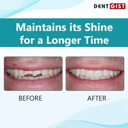 DentGist NanoCom Restorative Composite Refills 4g