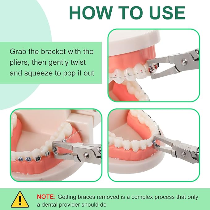 Koden Anterior Bracket Remover (Euphoria League)