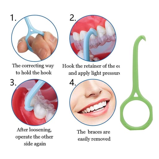 U Ortho Clear Aligner Removers (Pack of 1)