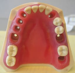 API Jaw Set with Typodonts  - 7