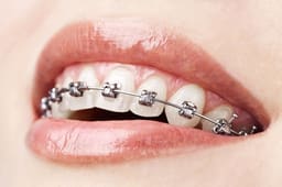 Ortho 
