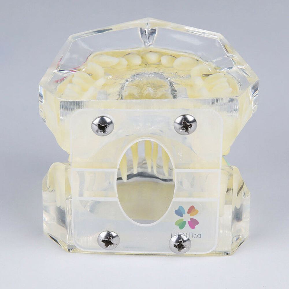 iDENTical Dental Orthodontic Models M3005