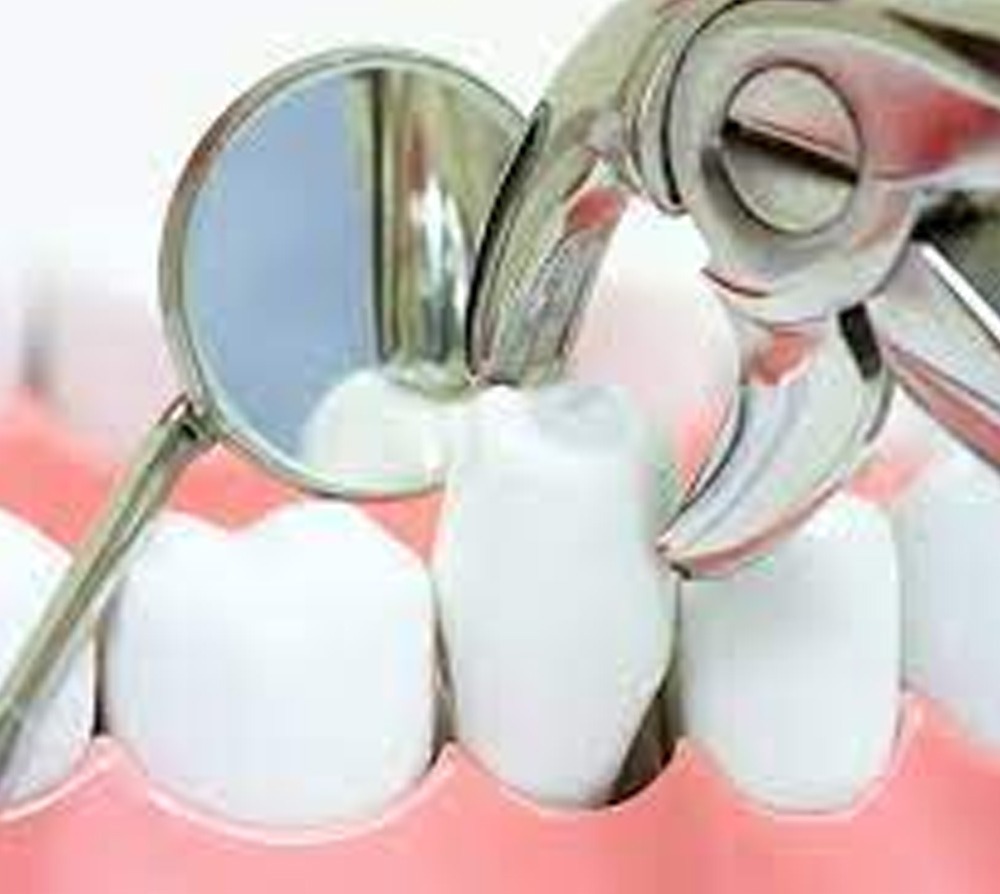 Waldent Extraction Forceps Kit Set of 14 (K1/7)